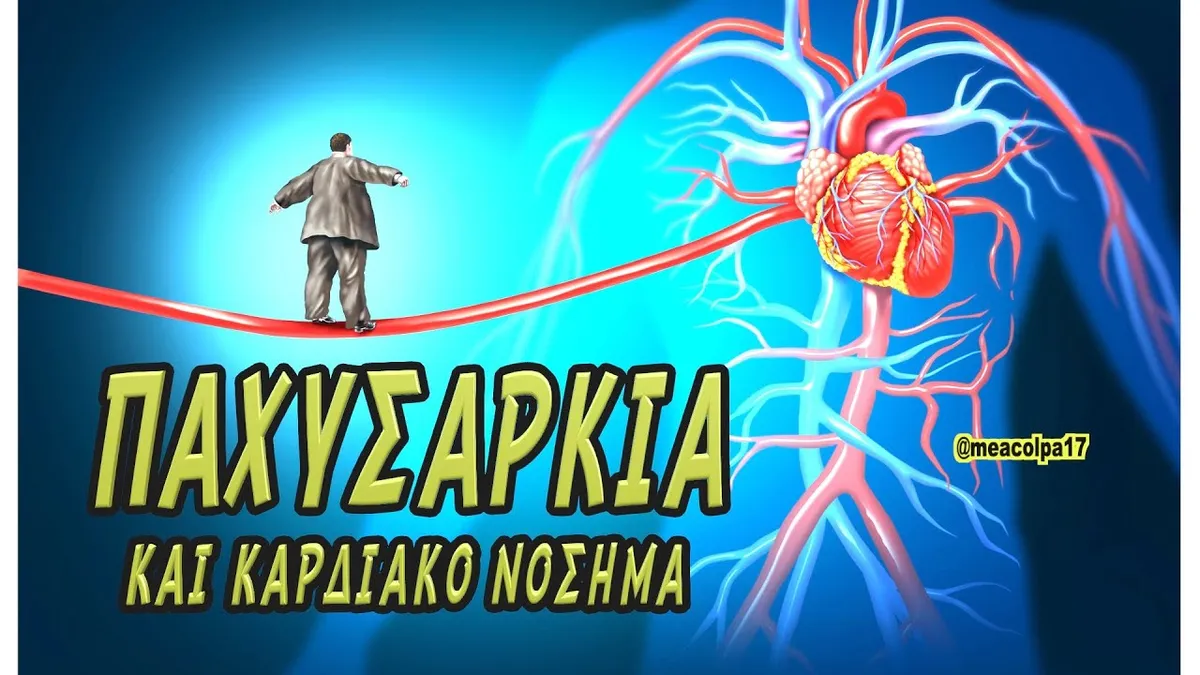 παχυσαρκία — GR news